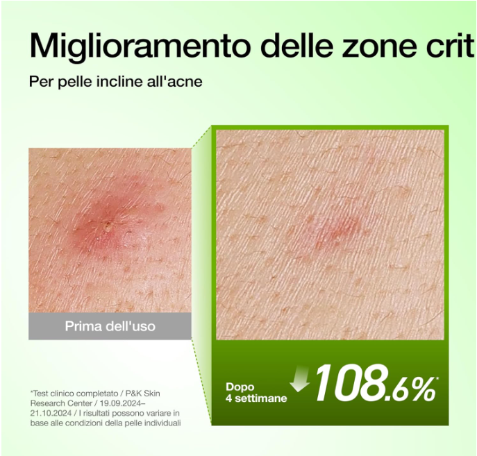 Anua  Azelaic Acid 10 Hyaluron Redness Soothing Serum